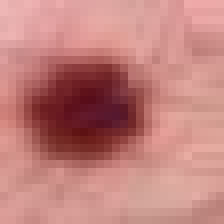 dermamnist_sample.png